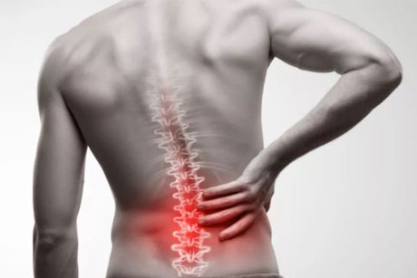 Back Pain